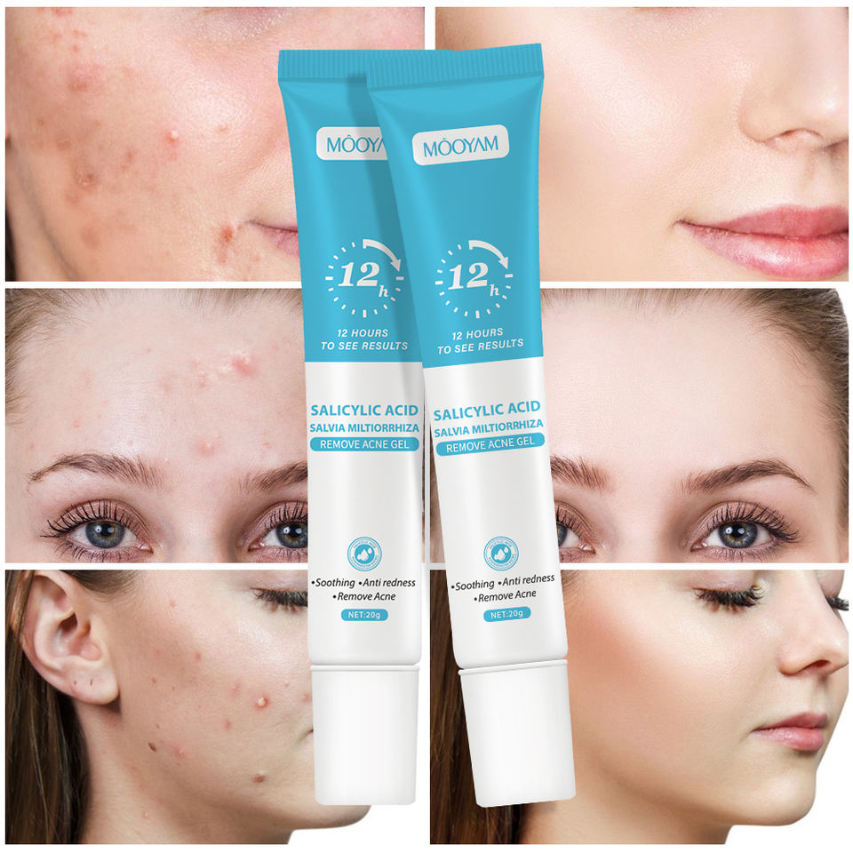 Flawless Skin Restoration Gel™