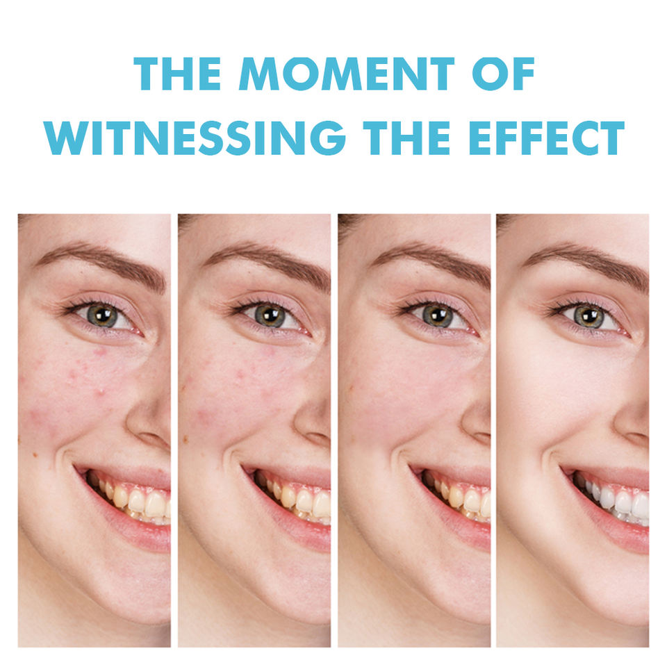 Flawless Skin Repair Gel™