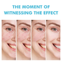 Flawless Skin Repair Gel™